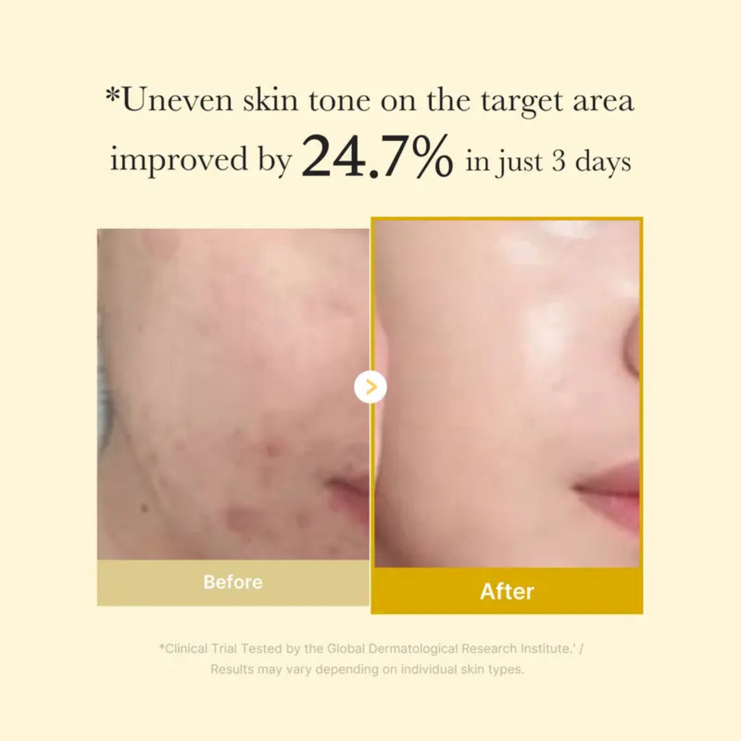 Kojic Acid Turmeric Wrapping Mask