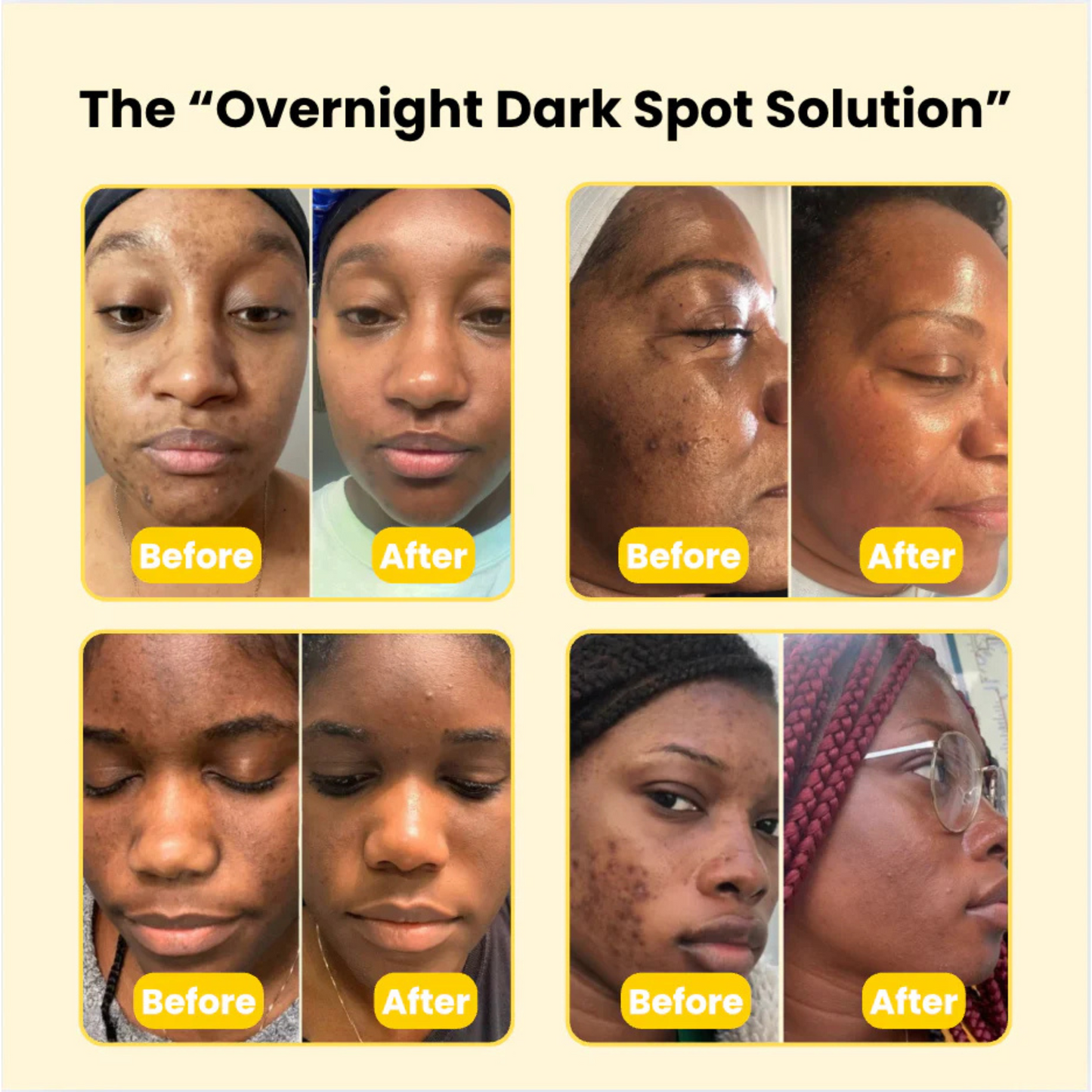 Kojic Acid Turmeric Wrapping Mask
